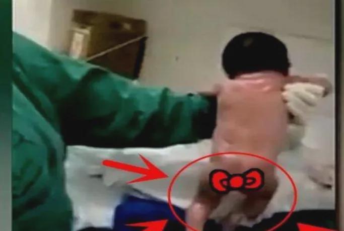 比分直播-&amp;quot;最猛新生儿&amp;quot;走红！带着脐带站起来就想跑，医生险些都没能抓住
